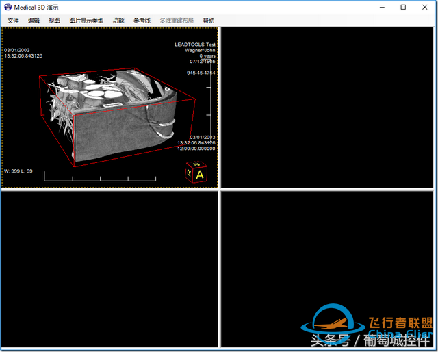 LEADTOOLS醫(yī)學(xué)三維影像演示使用入門-9909