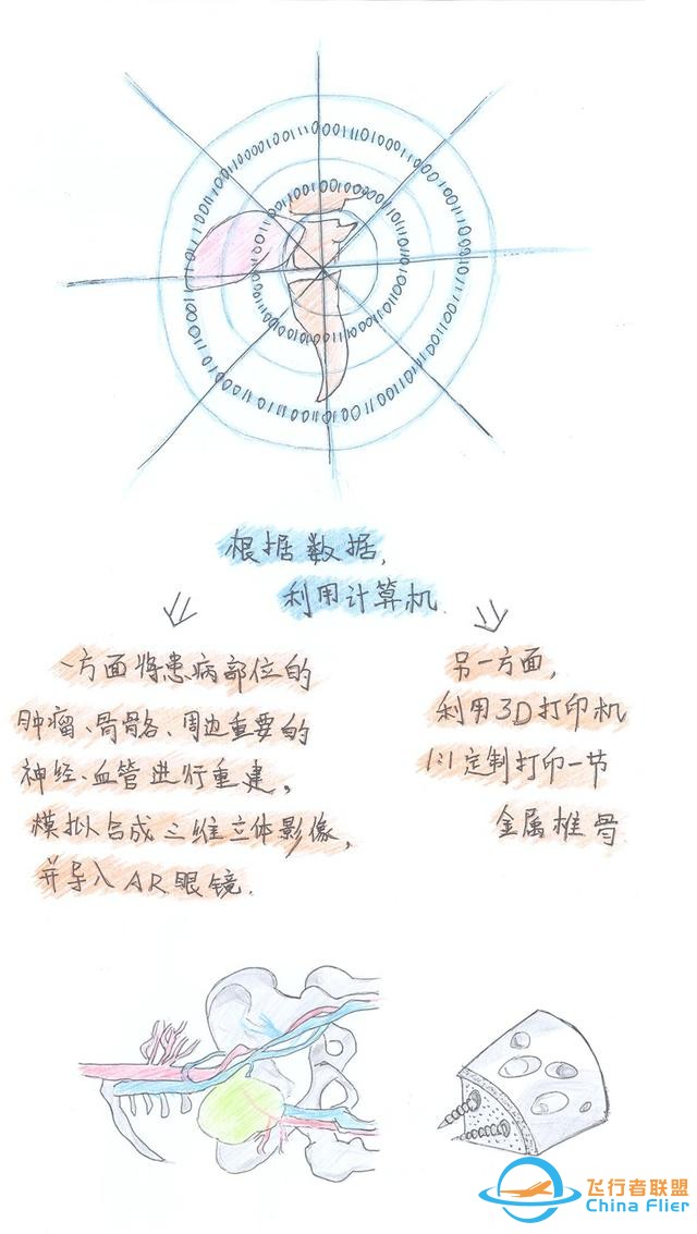 醫學領域的“AR 3D”技術究竟有多炫？10幅手繪漫畫給你講透-1616
