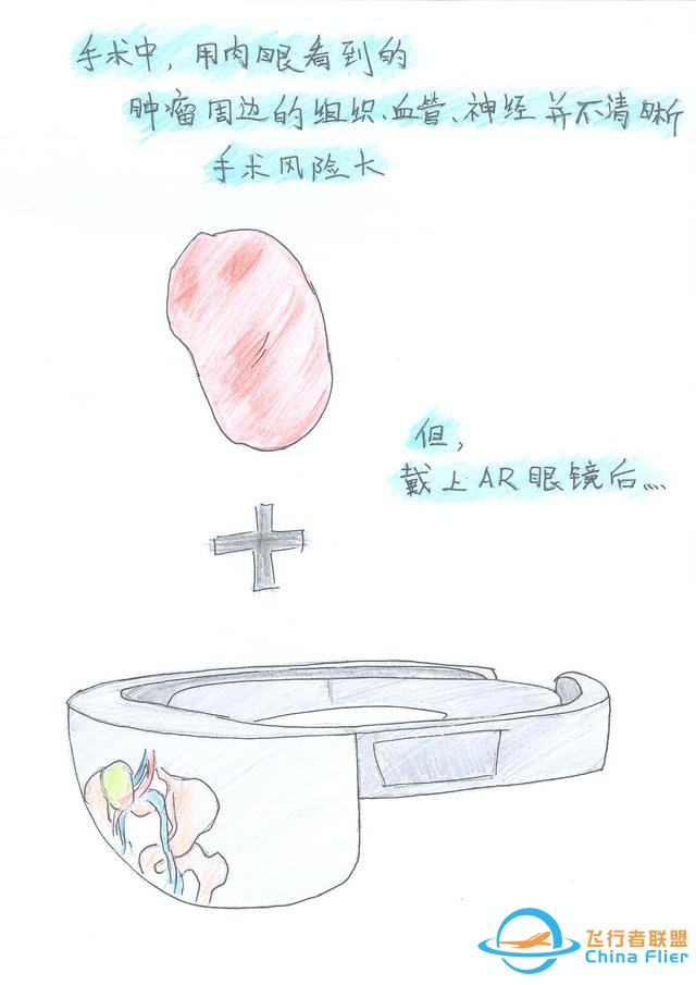 醫學領域的“AR 3D”技術究竟有多炫？10幅手繪漫畫給你講透-8152