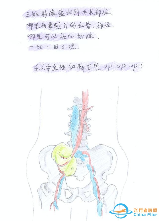 醫學領域的“AR 3D”技術究竟有多炫？10幅手繪漫畫給你講透-5305